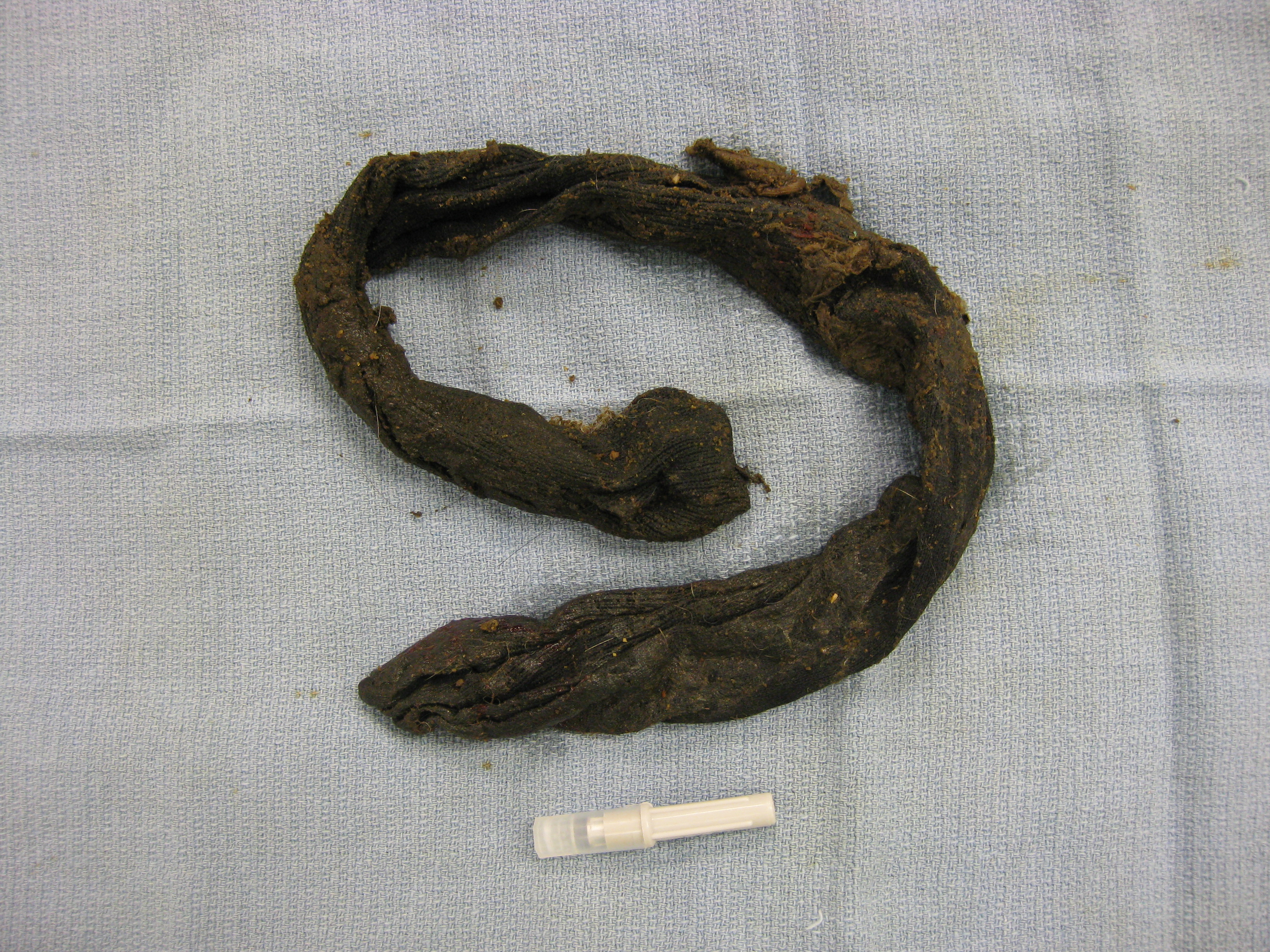 Sock removed from the intestine of a 4 year old German Shepherd