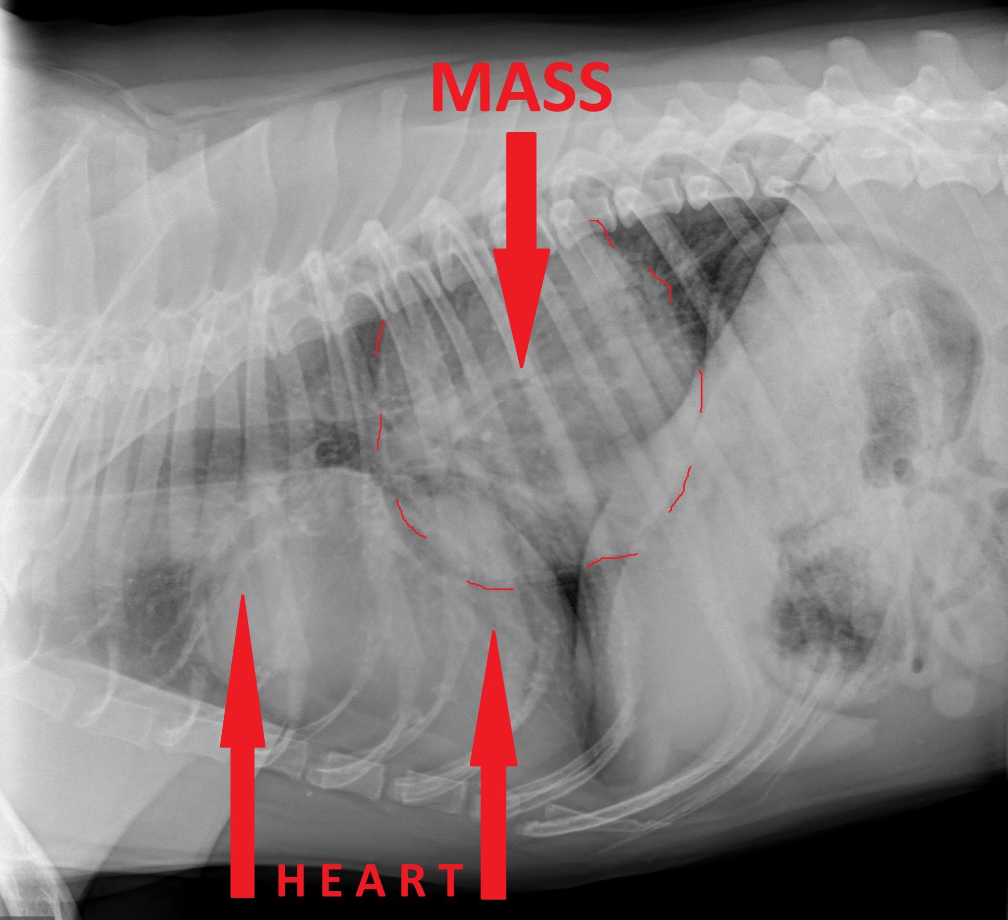 A mass in Nino's chest