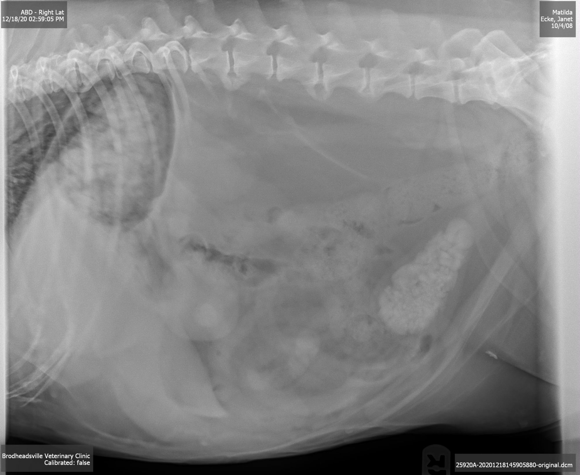 Bladder stones in the x-ray